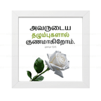 அவருடைய தழும்புகளால் குணமாகிறோம் - Isaiah 53:5 - Tamil