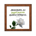 அவருடைய தழும்புகளால் குணமாகிறோம் - Isaiah 53:5 - Tamil